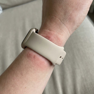 Jouw bandje is een broeinest voor bacteriën